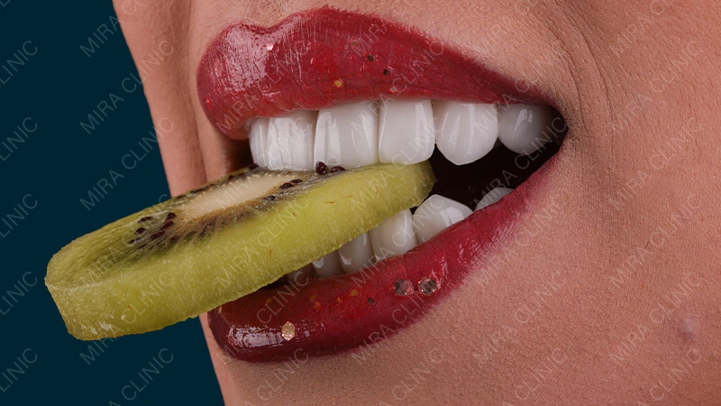 Eating and Drinking with Veneers